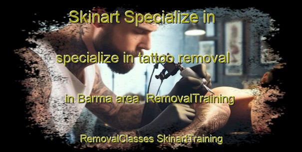 Skinart Specialize in specialize in tattoo removal in Barma area | #RemovalTraining #RemovalClasses #SkinartTraining-Bangladesh